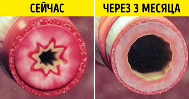 20 хитростей, которые реально помогают бросить курить и не сорваться Интересное