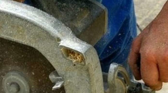 Жінка отпилила собі руку заради страхової виплати