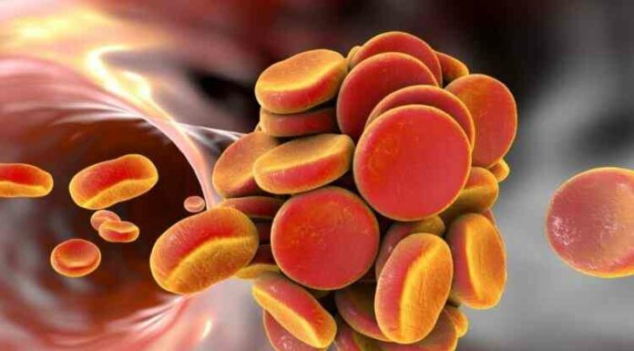 Тромби в крові будуть виявляти лазерним датчиком