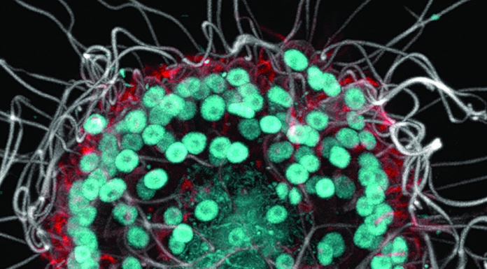 Тайна микроскопического симбиоза в озере Моно