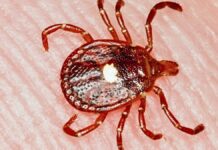 Перша підтверджена смерть від кліщової алергії на червоне м’ясо викликає занепокоєння у сфері охорони здоров’я