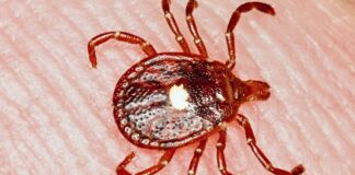 Перша підтверджена смерть від кліщової алергії на червоне м’ясо викликає занепокоєння у сфері охорони здоров’я