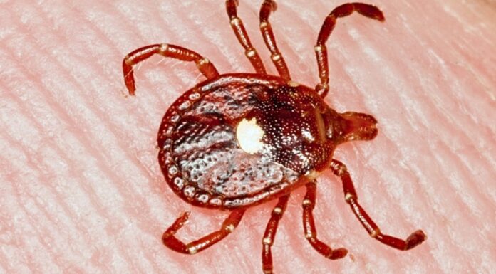 Перша підтверджена смерть від кліщової алергії на червоне м’ясо викликає занепокоєння у сфері охорони здоров’я