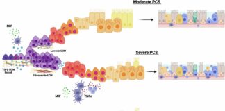 Нове дослідження пов’язує запалення носа з довгостроковими симптомами у пацієнтів, які перенесли COVID