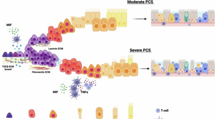 Нове дослідження пов’язує запалення носа з довгостроковими симптомами у пацієнтів, які перенесли COVID