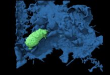 Ракові клітини уникають імунного захоплення через рух