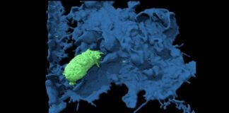 Ракові клітини уникають імунного захоплення через рух