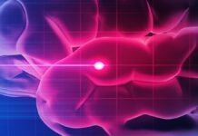 Наноматеріал захищає мозок після інсульту в дослідженні на мишах