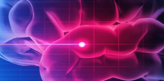 Наноматеріал захищає мозок після інсульту в дослідженні на мишах