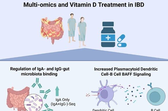 Вітамін D Змінює Імунну Відповідь при Запальних Захворюваннях Кишечника