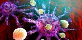 Voorbij onderdrukking: kan CAR T-celtherapie een permanente genezing bieden voor auto-immuunziekten?