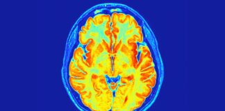 Вчені знайшли новий розлад нервової системи, прихований у наших генах