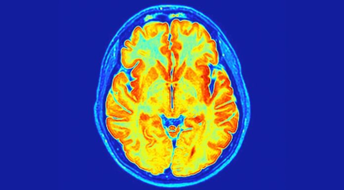 Вчені знайшли новий розлад нервової системи, прихований у наших генах